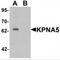 Karyopherin Subunit Alpha 6 antibody, MBS150833, MyBioSource, Western Blot image 