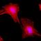 Tubulin alpha-1A chain antibody, NBP2-77401, Novus Biologicals, Immunofluorescence image 