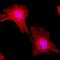 Tubulin Alpha 1a antibody, NBP2-77401, Novus Biologicals, Immunofluorescence image 