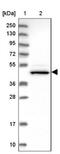 Sulfotransferase Hlo antibody, NBP1-91784, Novus Biologicals, Western Blot image 