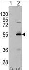 Aldehyde Dehydrogenase 6 Family Member A1 antibody, LS-B8999, Lifespan Biosciences, Western Blot image 