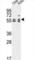 Tubulin-specific chaperone E antibody, abx034466, Abbexa, Western Blot image 