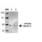 Beclin 2 antibody, LS-C776121, Lifespan Biosciences, Western Blot image 