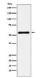 Chromobox 2 antibody, M06356, Boster Biological Technology, Western Blot image 