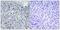 DNA Topoisomerase II Alpha antibody, GTX55437, GeneTex, Immunohistochemistry paraffin image 