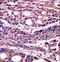 High Mobility Group Box 1 antibody, LS-C164932, Lifespan Biosciences, Immunohistochemistry paraffin image 