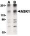 Mitogen-Activated Protein Kinase Kinase Kinase 5 antibody, PA5-20201, Invitrogen Antibodies, Western Blot image 