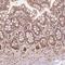 TBC1 Domain Family Member 17 antibody, NBP2-49546, Novus Biologicals, Immunohistochemistry frozen image 
