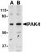 P21 (RAC1) Activated Kinase 4 antibody, MBS150320, MyBioSource, Western Blot image 