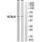 Inward rectifier potassium channel 4 antibody, A06605, Boster Biological Technology, Western Blot image 