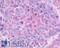 Gastrin Releasing Peptide Receptor antibody, LS-A830, Lifespan Biosciences, Immunohistochemistry frozen image 