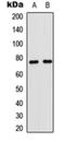 CD180 Molecule antibody, orb304714, Biorbyt, Western Blot image 