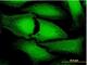 Ankyrin Repeat And FYVE Domain Containing 1 antibody, H00051479-B01P, Novus Biologicals, Immunofluorescence image 