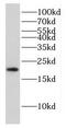 Fas Apoptotic Inhibitory Molecule antibody, FNab02949, FineTest, Western Blot image 