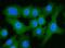 ATP Citrate Lyase antibody, PB10024, Boster Biological Technology, Immunofluorescence image 