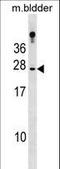 Retinol Binding Protein 4 antibody, LS-C155963, Lifespan Biosciences, Western Blot image 