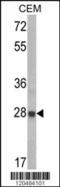 Insulin-like growth factor-binding protein 6 antibody, MBS9209674, MyBioSource, Western Blot image 