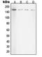 Rho Associated Coiled-Coil Containing Protein Kinase 1 antibody, MBS820812, MyBioSource, Western Blot image 