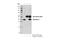 Arginase 2 antibody, 19324S, Cell Signaling Technology, Immunoprecipitation image 