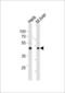 T-box transcription factor TBX6 antibody, LS-C161755, Lifespan Biosciences, Western Blot image 