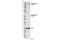 Nuclear Receptor Coactivator 3 antibody, 2979S, Cell Signaling Technology, Western Blot image 