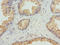 Beta-2-Microglobulin antibody, A57870-100, Epigentek, Immunohistochemistry paraffin image 