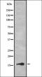 Laminin Subunit Beta 3 antibody, orb335193, Biorbyt, Western Blot image 