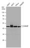 Vasodilator Stimulated Phosphoprotein antibody, GTX132176, GeneTex, Western Blot image 