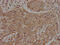 Insulin Receptor Related Receptor antibody, CSB-PA011755LA01HU, Cusabio, Immunohistochemistry frozen image 