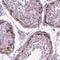 Insulin Like Growth Factor 2 MRNA Binding Protein 1 antibody, NBP2-38956, Novus Biologicals, Immunohistochemistry frozen image 