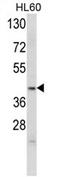 Apolipoprotein L4 antibody, AP17119PU-N, Origene, Western Blot image 