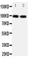 Glutamate Ionotropic Receptor AMPA Type Subunit 2 antibody, PA1598, Boster Biological Technology, Western Blot image 