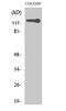 hTERT antibody, STJ95971, St John