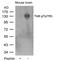 Neurotrophic Receptor Tyrosine Kinase 2 antibody, 79-502, ProSci, Western Blot image 