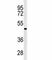 GATA Binding Protein 6 antibody, F49005-0.4ML, NSJ Bioreagents, Western Blot image 