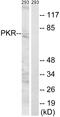 Eukaryotic Translation Initiation Factor 2 Alpha Kinase 2 antibody, LS-C118322, Lifespan Biosciences, Western Blot image 