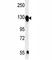 Integrin Subunit Alpha 5 antibody, F49220-0.4ML, NSJ Bioreagents, Western Blot image 