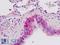 Insulin Like Growth Factor Binding Protein 2 antibody, LS-B9078, Lifespan Biosciences, Immunohistochemistry paraffin image 