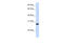 Deoxycytidine Kinase antibody, 26-614, ProSci, Western Blot image 