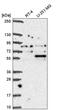 Coilin antibody, PA5-66995, Invitrogen Antibodies, Western Blot image 