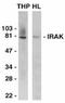 Interleukin 1 Receptor Associated Kinase 1 antibody, ADI-905-709-100, Enzo Life Sciences, Western Blot image 