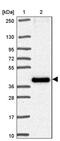 Transmembrane Protein 184C antibody, PA5-62896, Invitrogen Antibodies, Western Blot image 