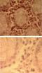 Toll Like Receptor 7 antibody, NBP2-24906, Novus Biologicals, Immunohistochemistry paraffin image 