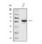 Transforming Growth Factor Beta Receptor 1 antibody, A00832, Boster Biological Technology, Western Blot image 