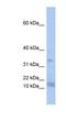 Splicing Factor 3b Subunit 6 antibody, NBP1-57226, Novus Biologicals, Western Blot image 