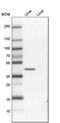 PR/SET Domain 12 antibody, PA5-60257, Invitrogen Antibodies, Western Blot image 