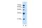 Solute Carrier Family 17 Member 3 antibody, GTX47050, GeneTex, Western Blot image 
