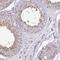 Protein Phosphatase, Mg2+/Mn2+ Dependent 1J antibody, NBP2-13797, Novus Biologicals, Immunohistochemistry paraffin image 