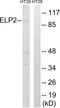 Elongator complex protein 2 antibody, LS-C119955, Lifespan Biosciences, Western Blot image 