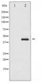 SMAD Family Member 3 antibody, LS-C416738, Lifespan Biosciences, Western Blot image 
